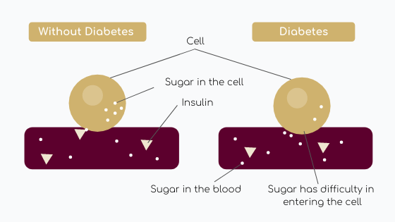 Type II diabetes